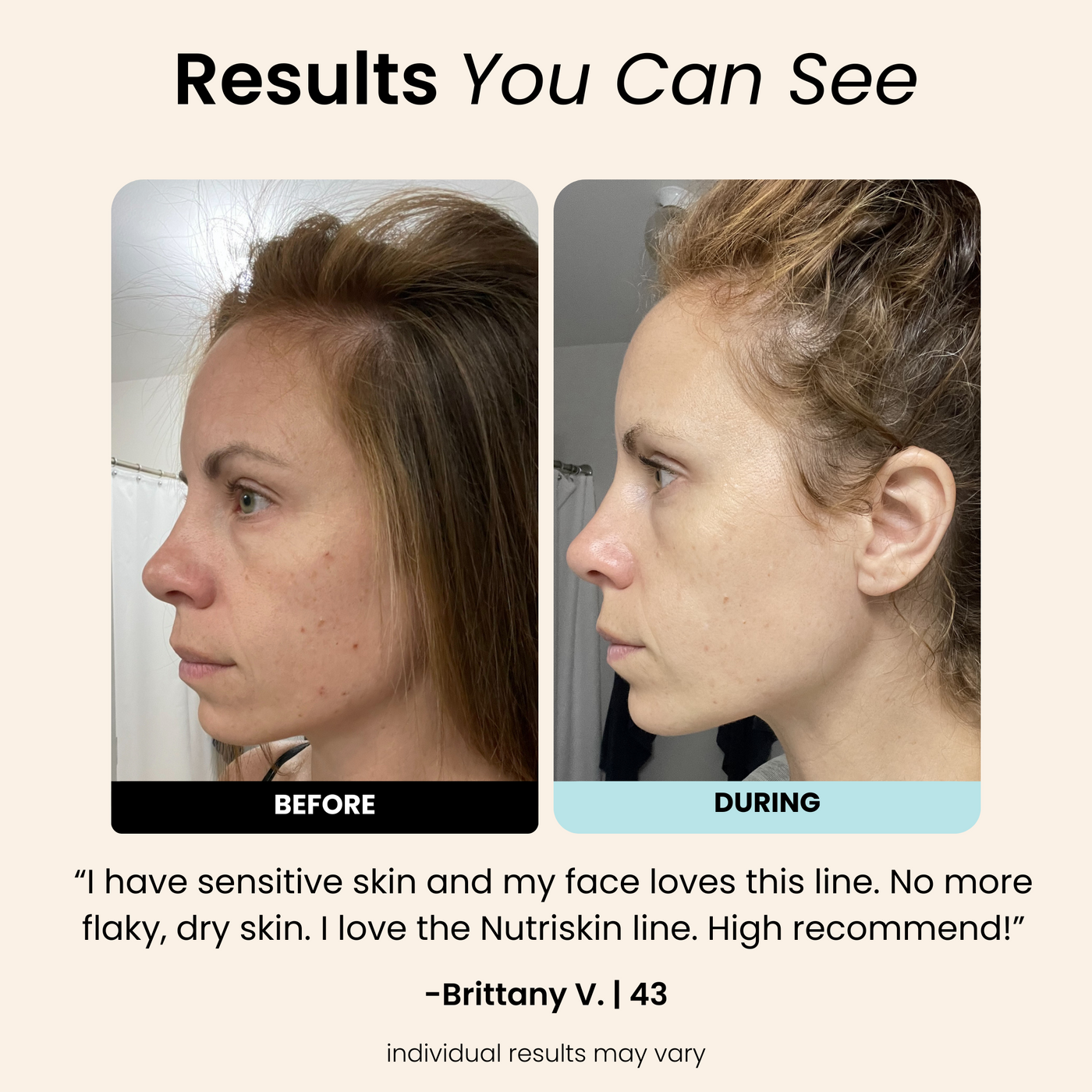 Misty Rose Water LED Activator Facial Toner
