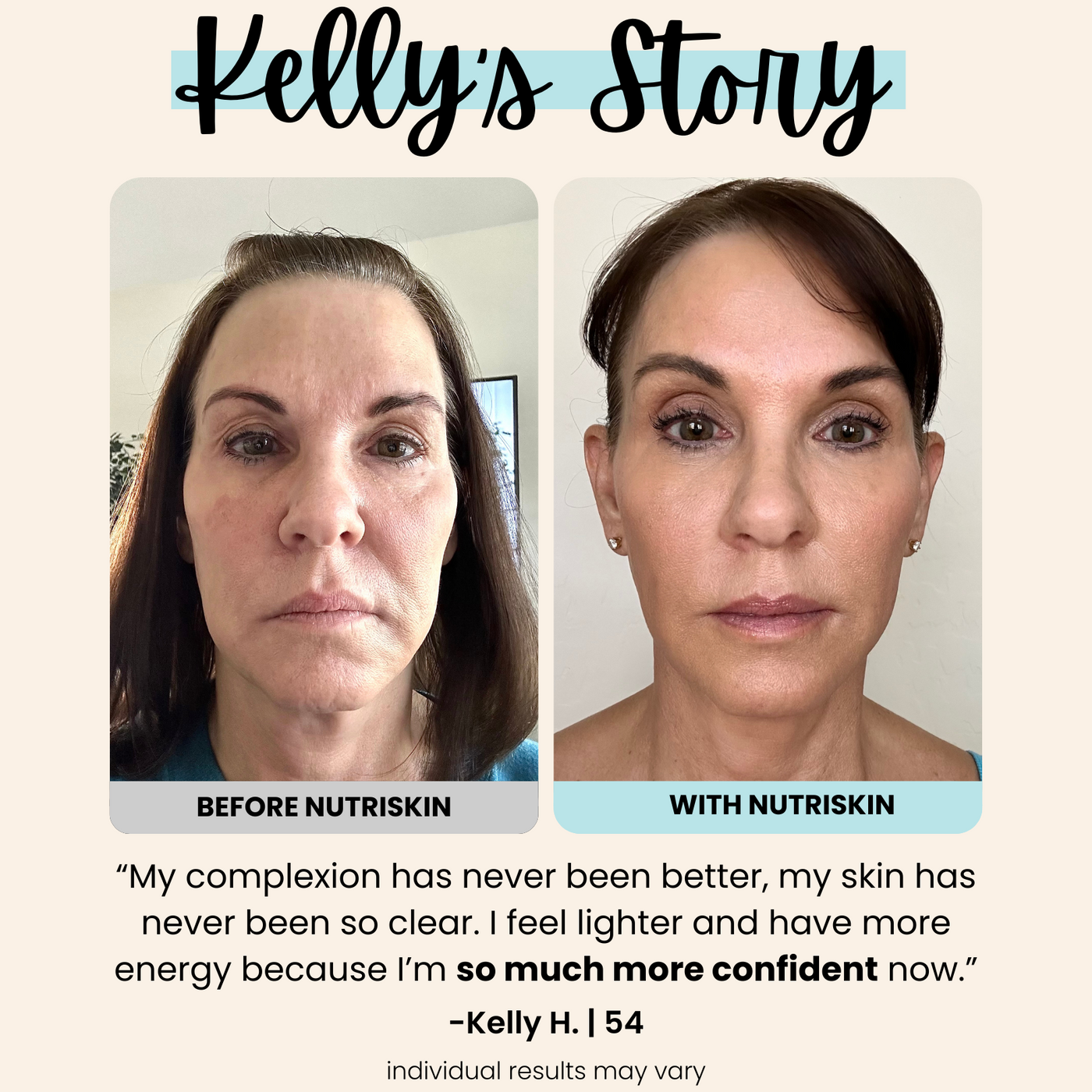 Silicone Wrinkle Clearing Light Therapy Face Mask (FREE Neck & Décolleté Mask Included $399 Value)