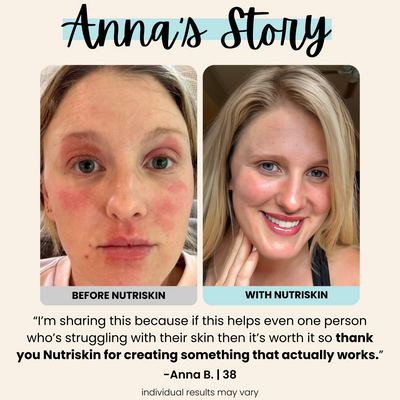 Silicone Wrinkle Clearing Light Therapy Face Mask (FREE Neck & Décolleté Mask Included $399 Value)